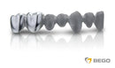 Mediloy® Titan Grade 5 SLM