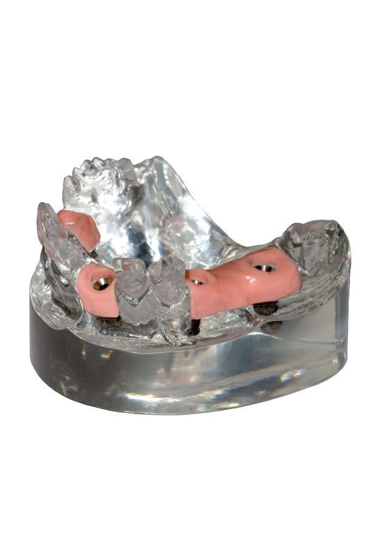 Modelo de demostración para maxilar superior